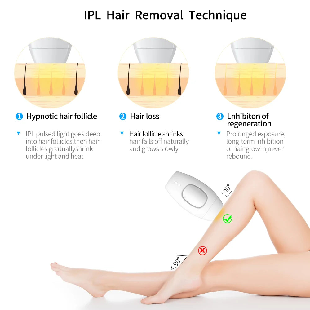 Laser epilator
