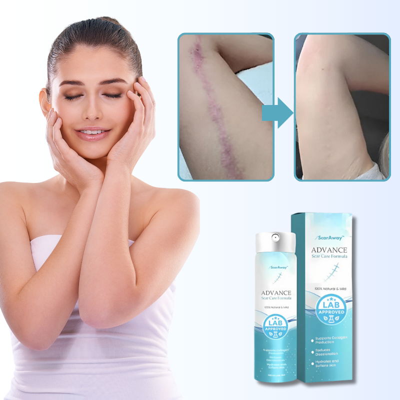 ScarAway™ Spray