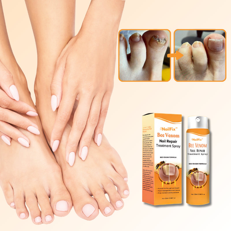 NailFix™