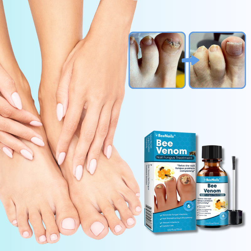 BeeNails™