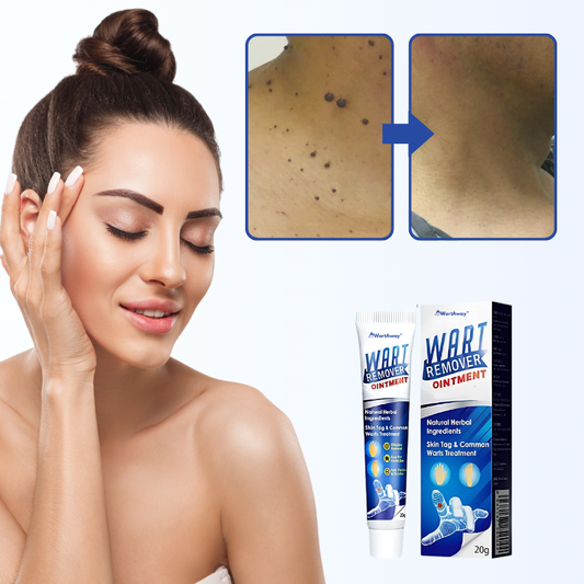 WartAway™ Crème