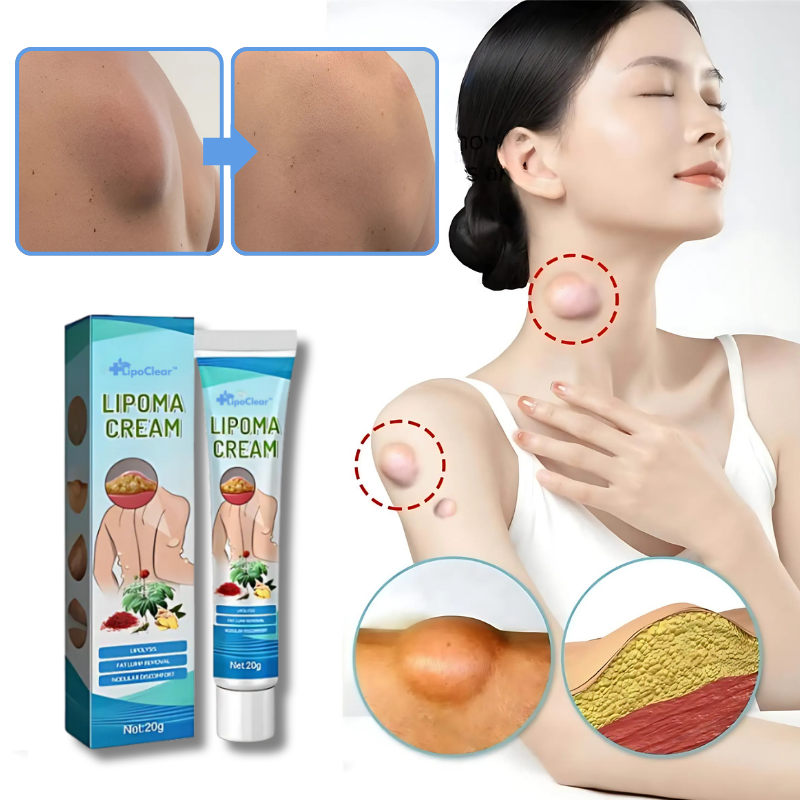 LipoClear™ Crème